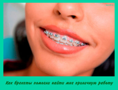 Как брекеты помогли найти мне работу